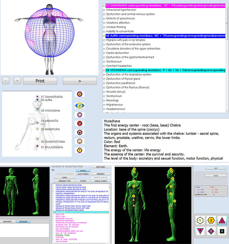 12D Nls Quantum Resonance Magnetic Analyzer Nls Diagnostics Bioresonance Therapy Device 12D Nls Health Analyzer