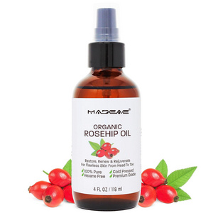 Reduces Fine Lines Rosehip Oil Calms Brightens Skin Reduces Appearance Of Dark Spots Scars rose essential oil