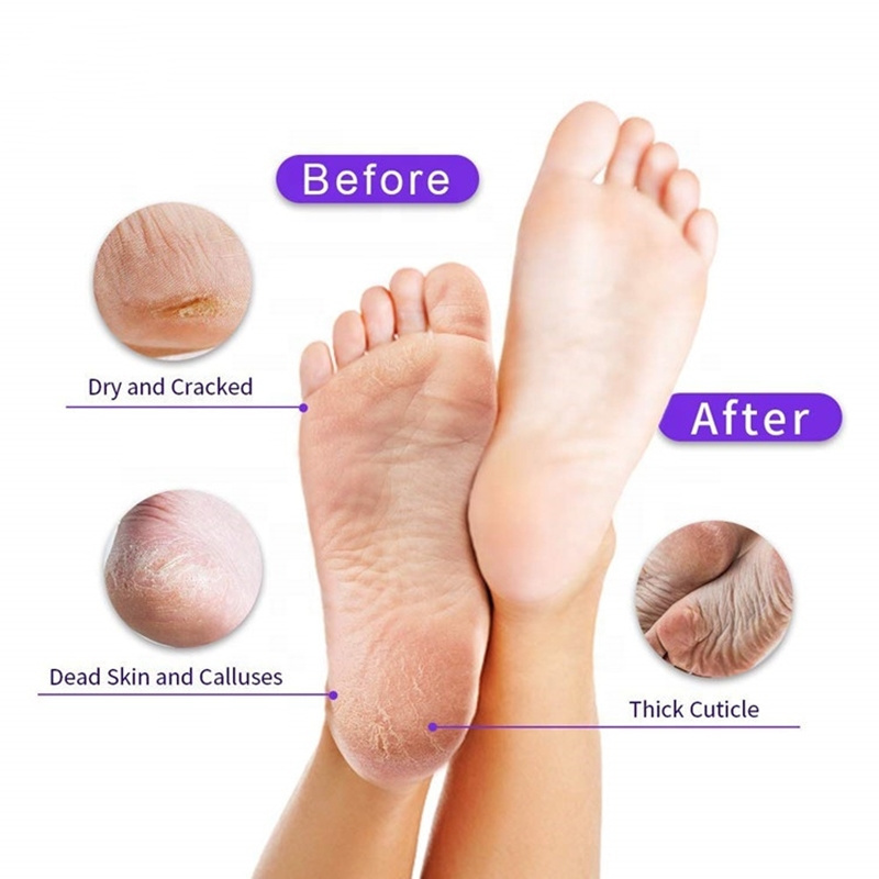 Feet Exfoliating Masks Pedicure Socks Exfoliation Scrub for Foot Remove Dead Skin Heels Foot Peeling Mask Cream Adults Female