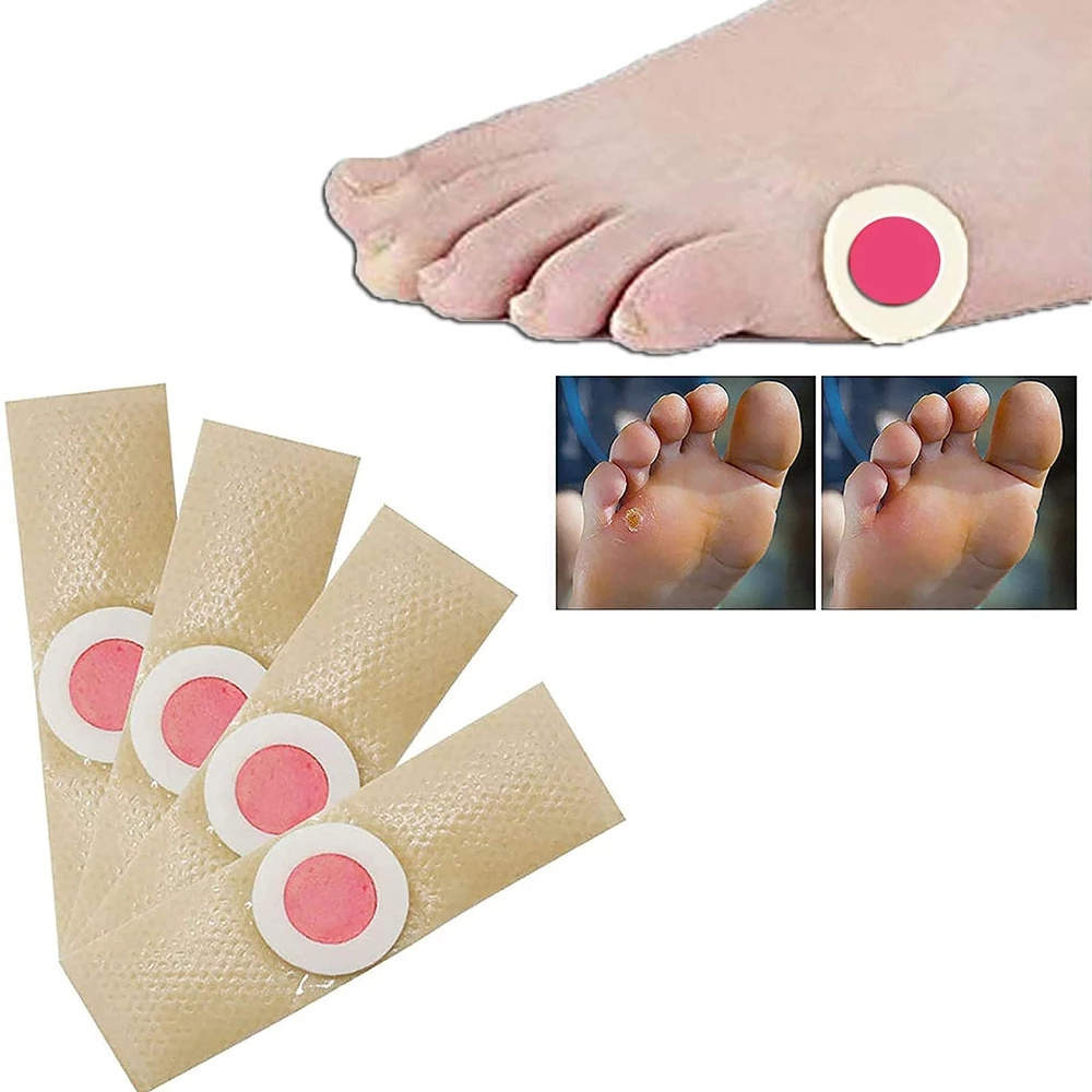 Chinese Traditional Herbal Ingredients Foot Corn Cocoon Sticker Remove Hand Corn Dead Skin Callus Remover