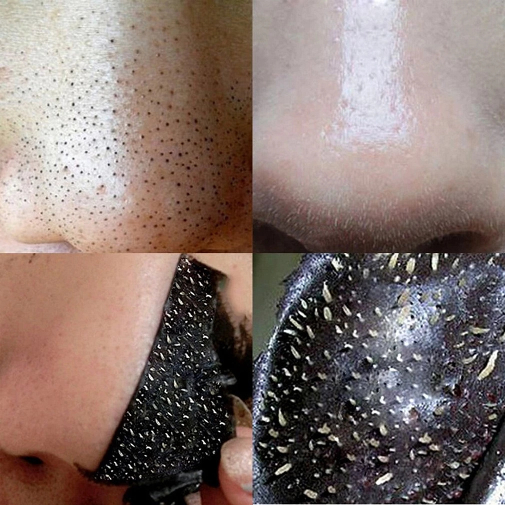 Free Sample Black Head Nose Dot Spot Purifying Peel Off Sticker Private Label  Bamboo Charcoal Deep Cleansing Nose Strips