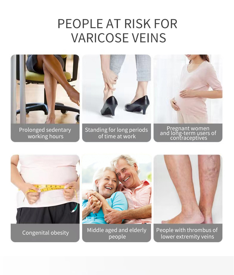 2024 HOT PRODUCT wholesale varicose veins patch Chinese herbal pain relief patch veins patches